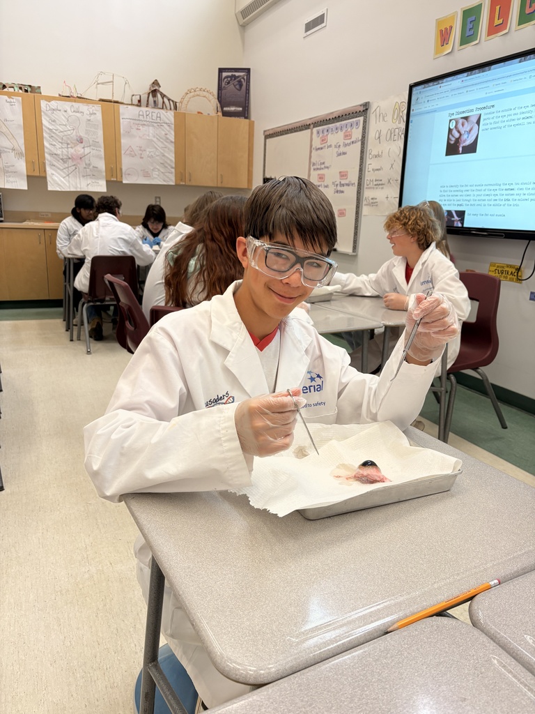 Dissecting Cow Eyes