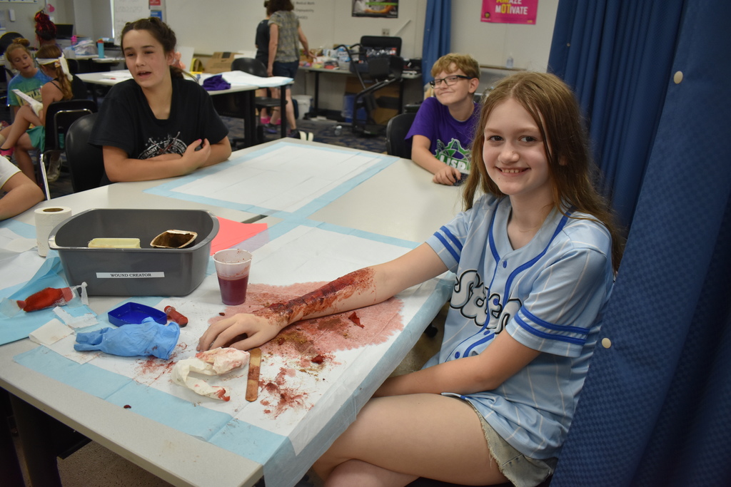 a student's fake wound
