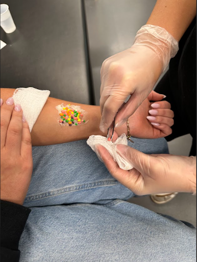 Close-up of a student in gloves using tweezers to remove colorful, small objects (like candy) from an arm, simulating foreign body removal.