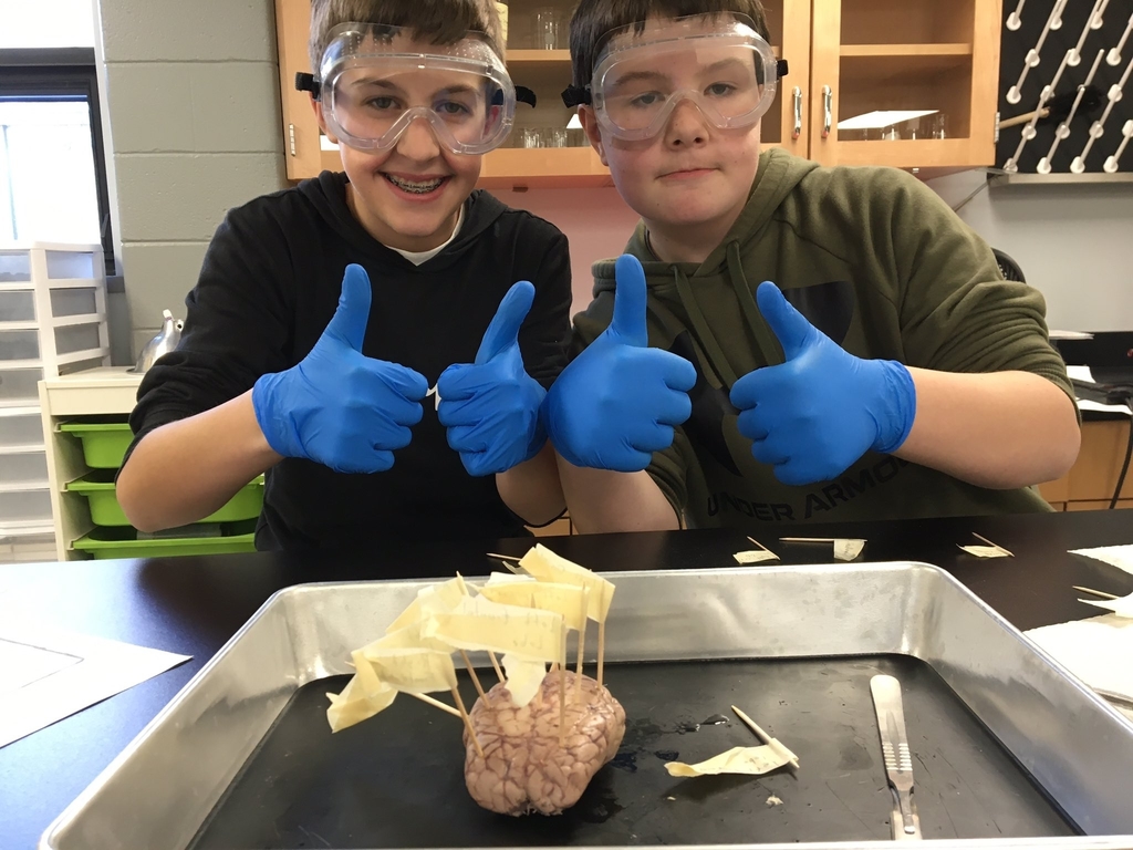 Brain Dissection