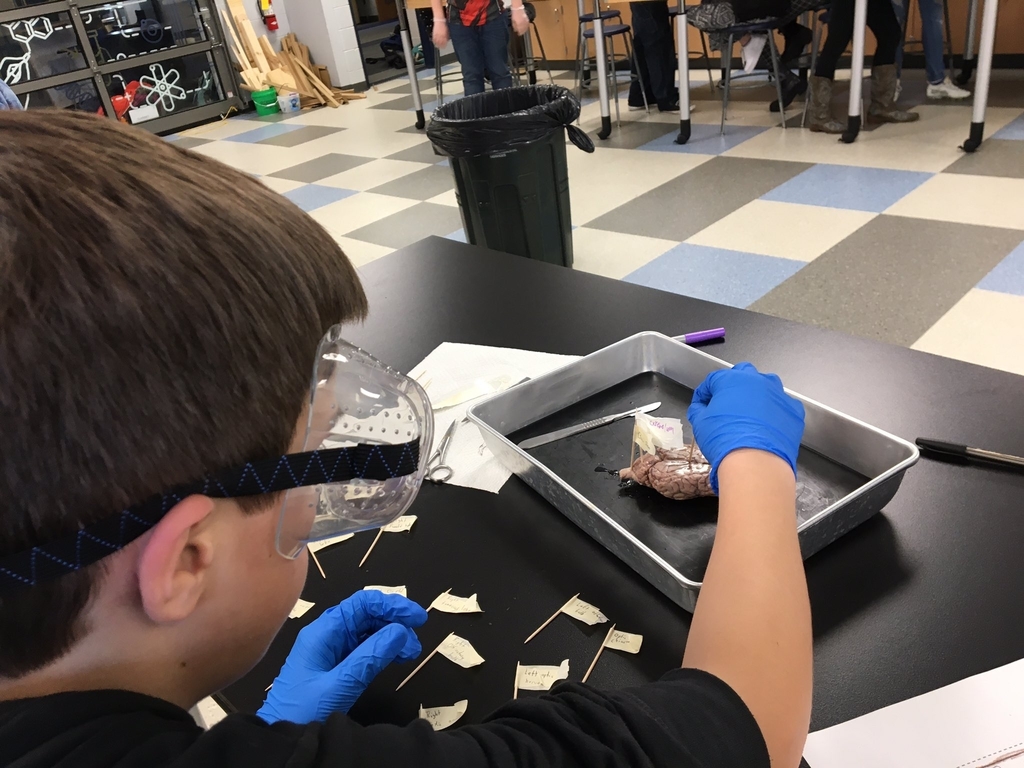 Brain Dissection in Medical Detectives