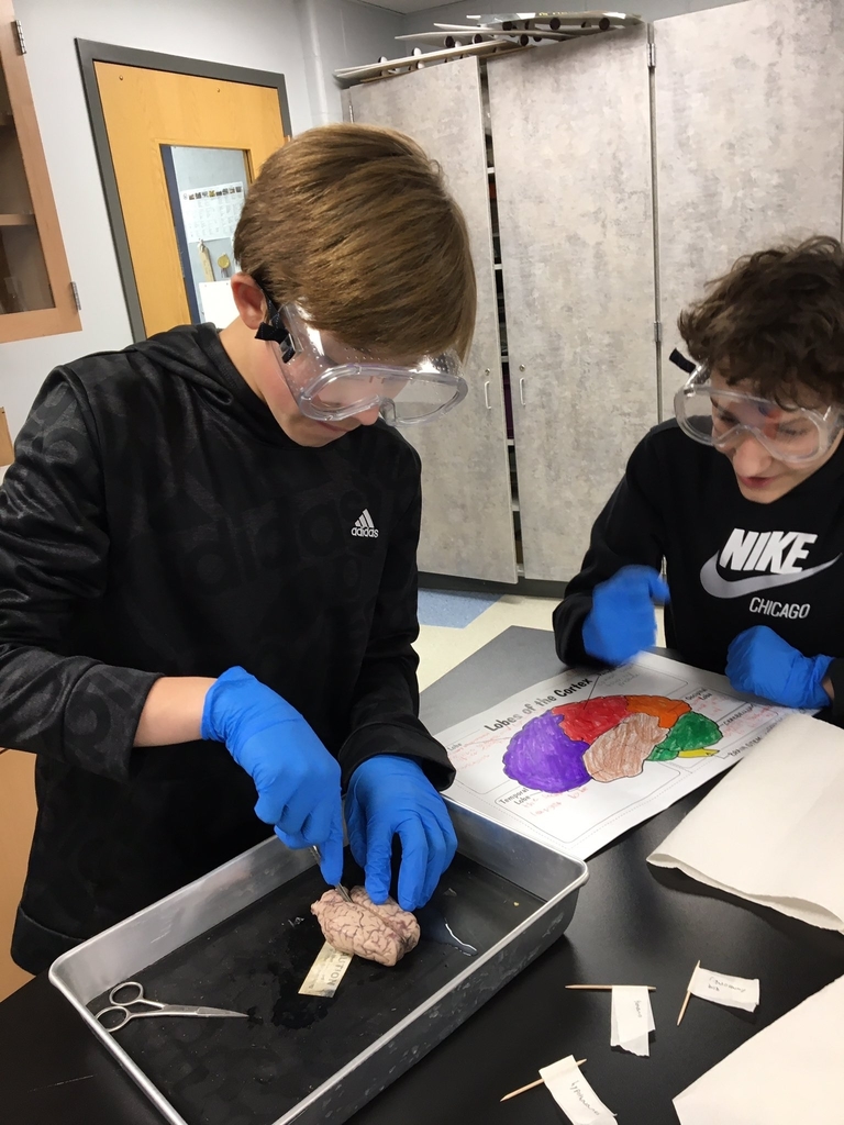 Brain Dissection in Medical Detectives