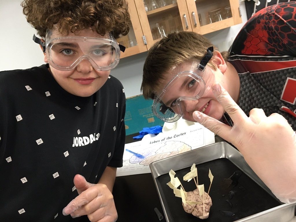 Brain Dissection in Medical Detectives