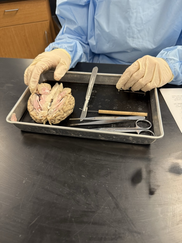 Sheep brain dissection in bio today 🧠