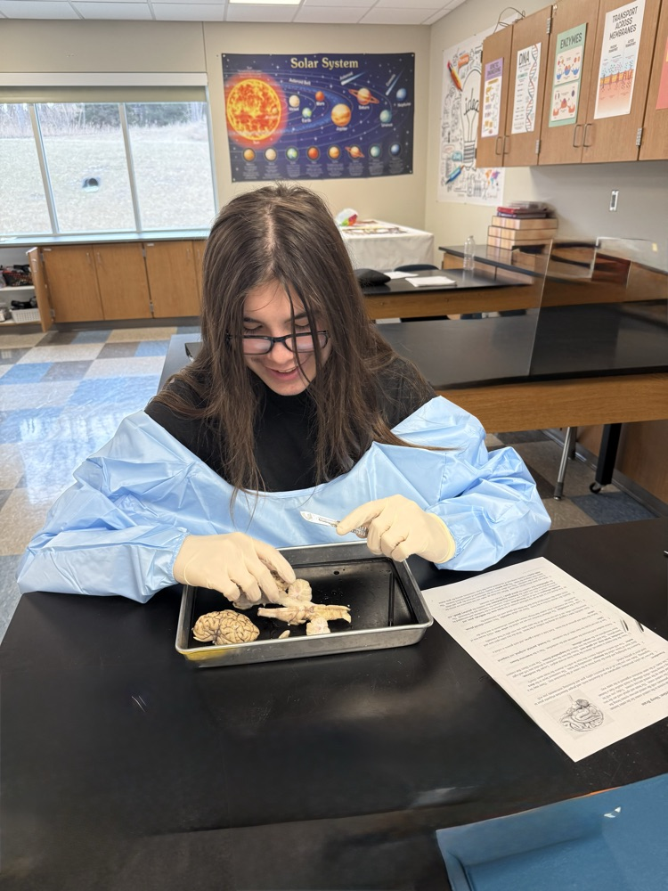 Sheep brain dissection in bio today 🧠