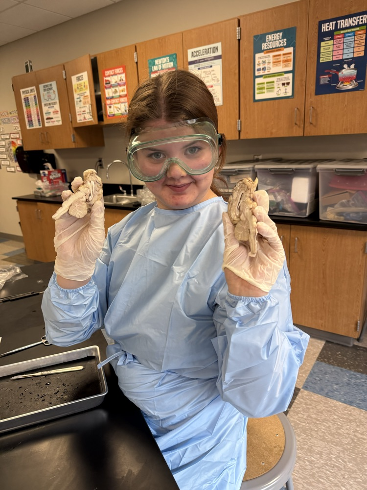 Sheep brain dissection in bio today 🧠