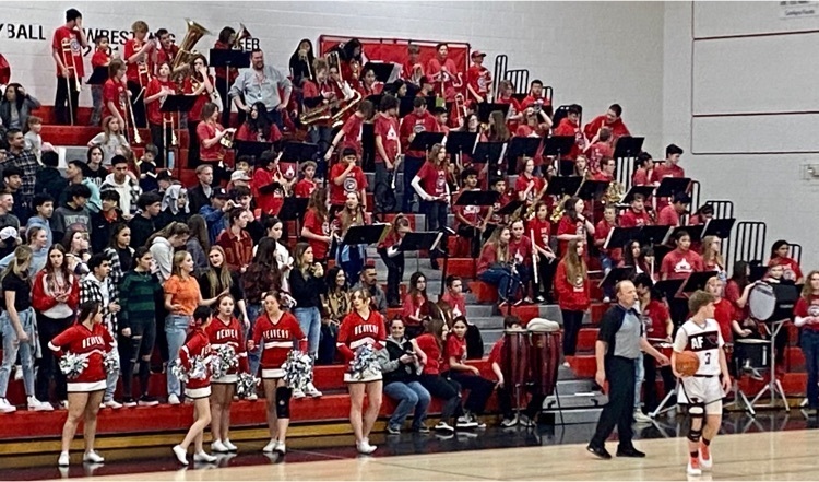 band