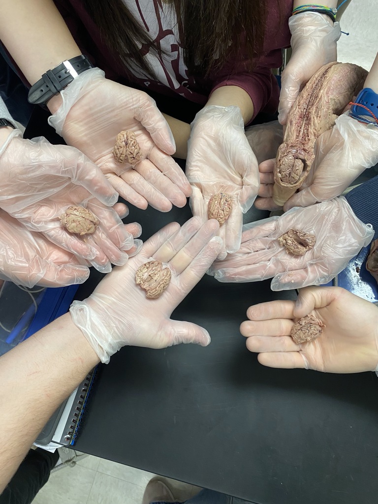 Successful brain removals!
