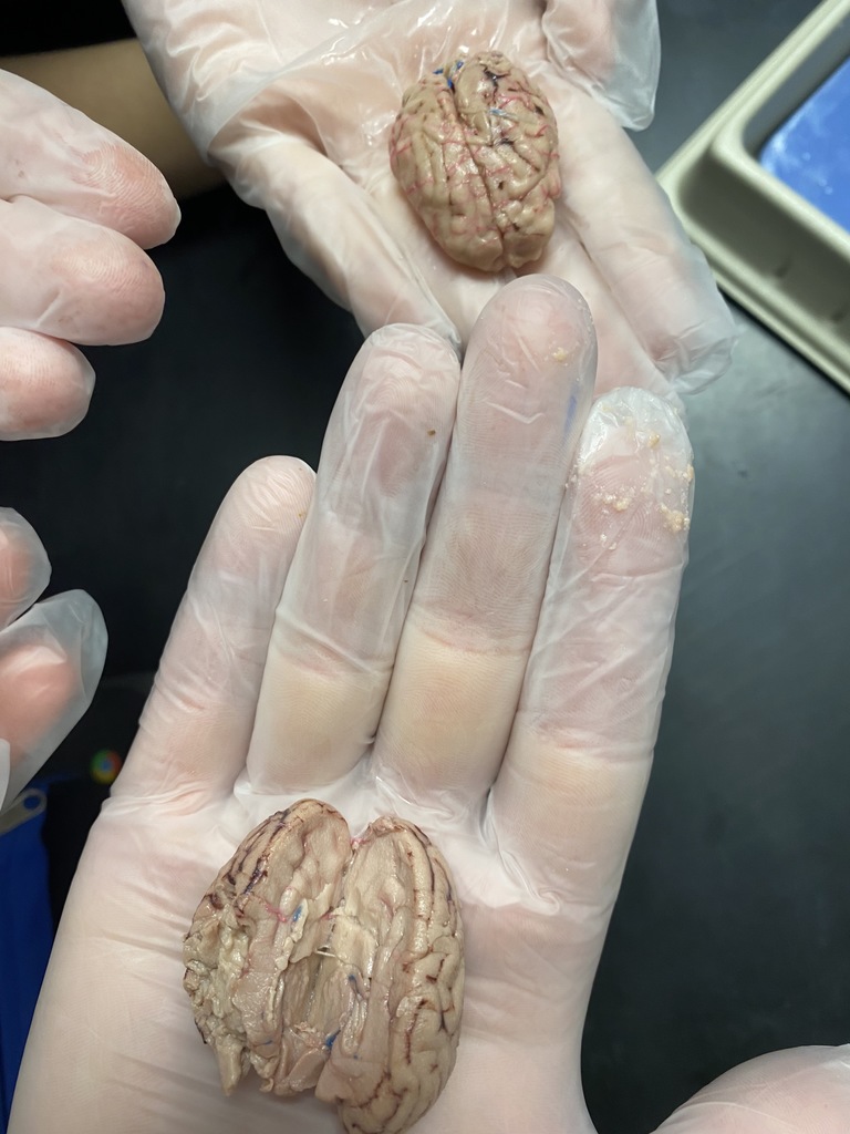 Identifying the brain structures!