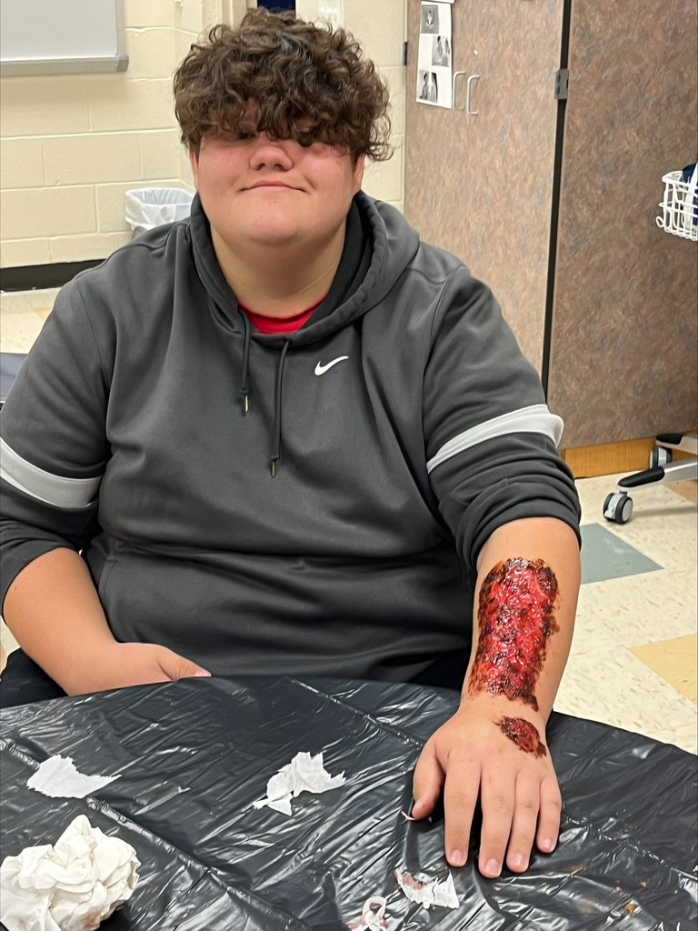 wound making 