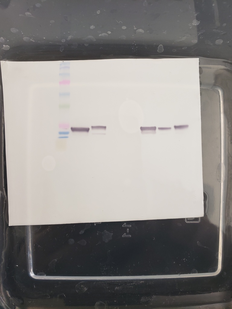 Western blot of myosin proteins in various tissue samples