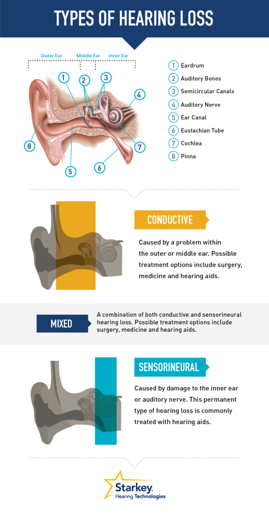 Types of Hearing Loss