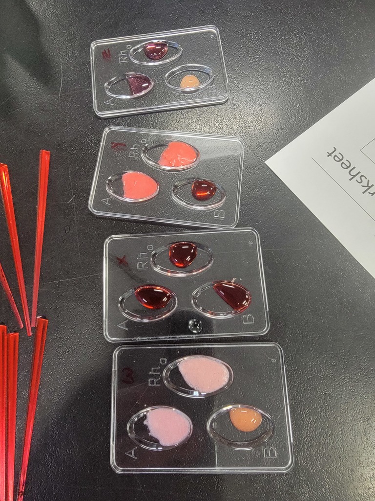 Results of the simulated blood typing lab.