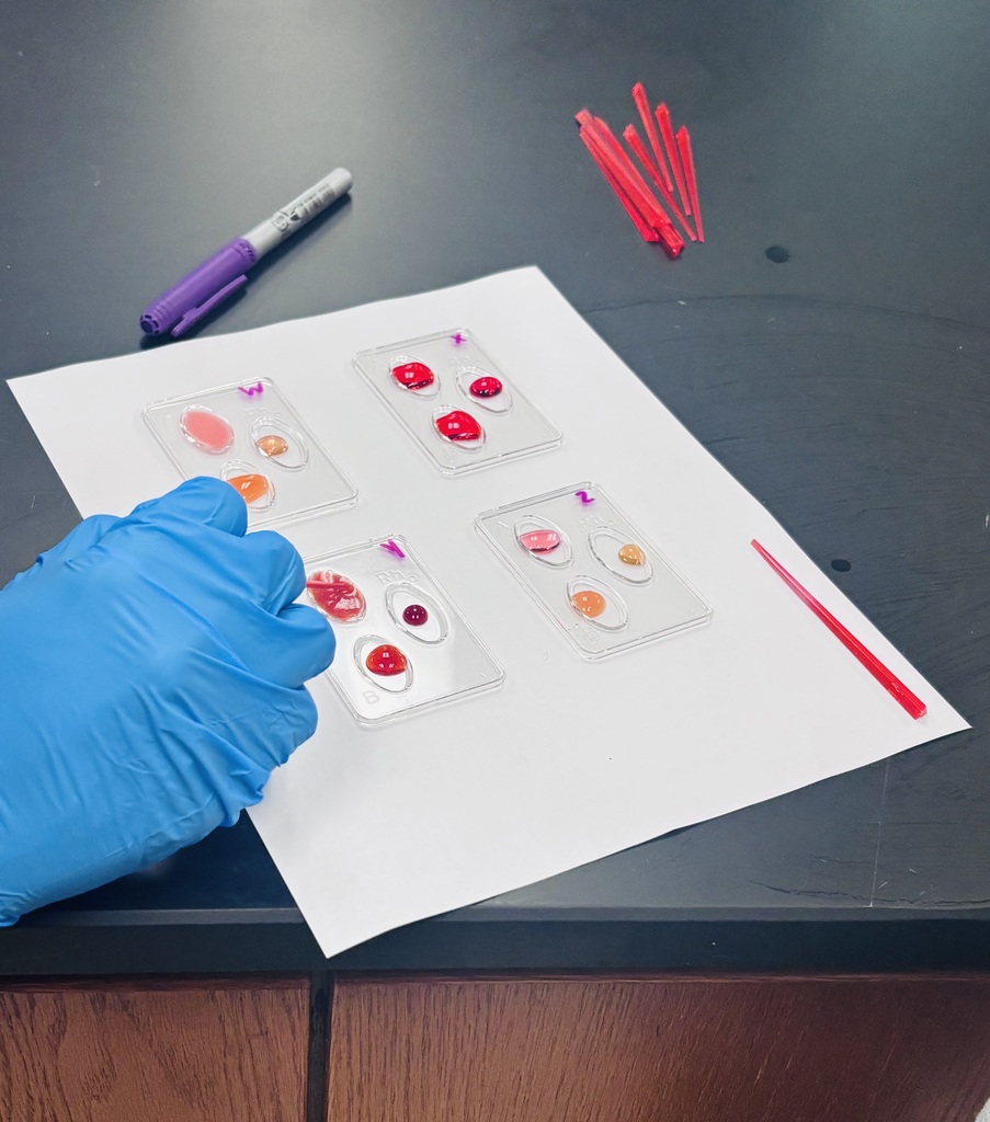 Our Anatomy & Physiology students have been hard at work diving into the cardiovascular system! 🫀  From learning how to measure blood pressure both manually and with electronic monitors, to exploring the structure of the heart through hands-on pig heart dissections, students gained valuable real-world experience. They also investigated the ABO blood group system and practiced blood typing using simulated patient samples.  Putting what they’ve learned into real-world practice!
