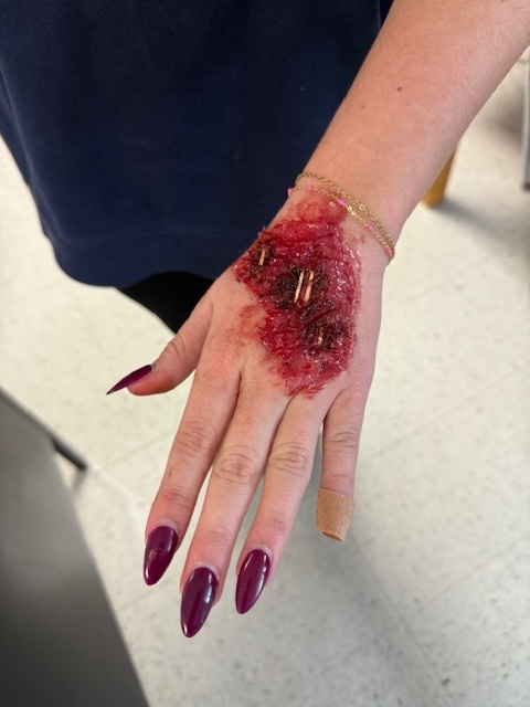 Students with burn marks and fake blood and bones