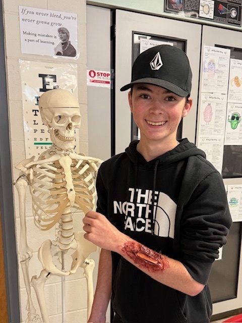 a boy with a hat showcasing his fake flesh wound next to a skeleton