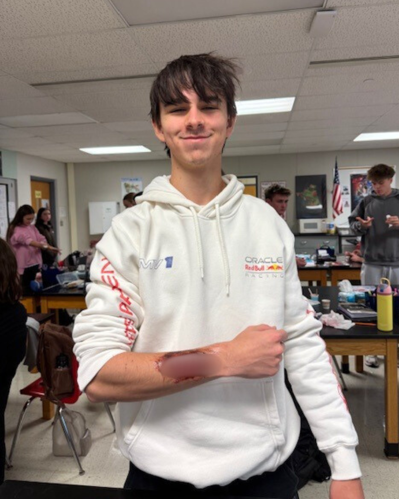 male student in a white sweatshirt with a fake bloody arm