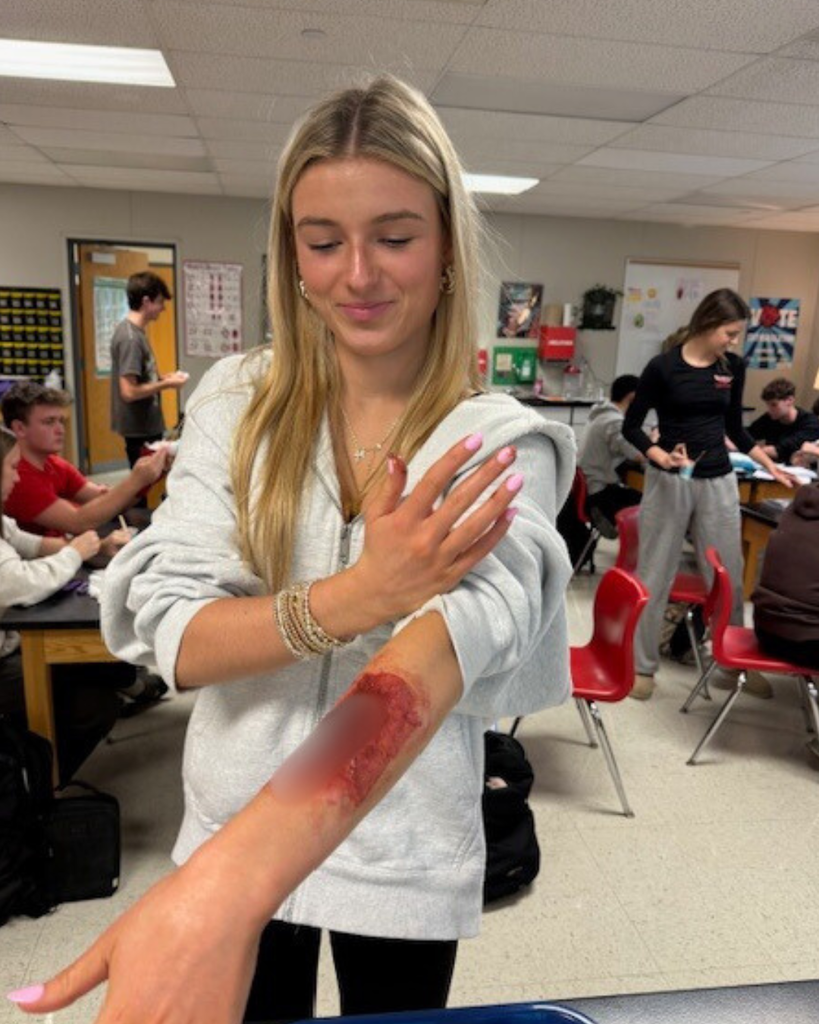 Student in a white sweatshirt with a bloody arm