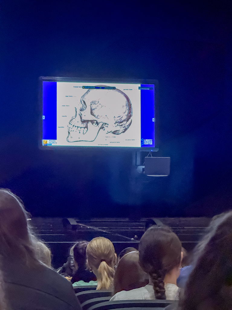 A close view of a large monitor displaying a labeled diagram of a human skull as students watch from the auditorium during the medical seminar.