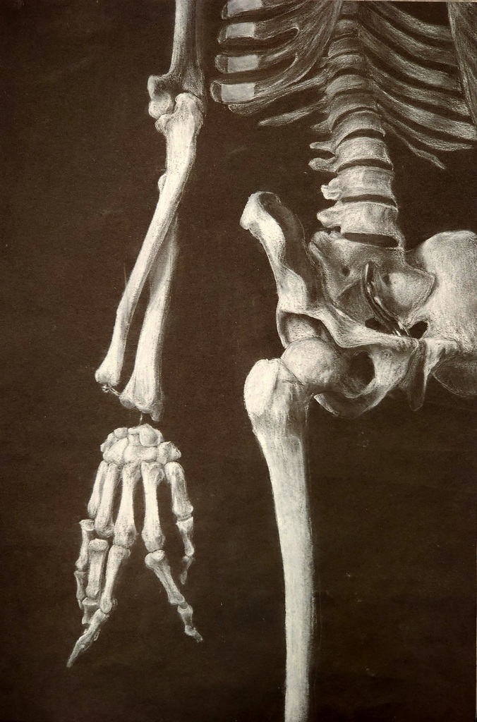 A drawing of a skeleton with splayed finger bones