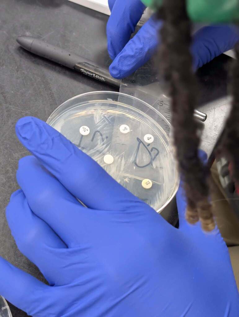 A person in blue gloves examines a petri dish with culture samples on a countertop.