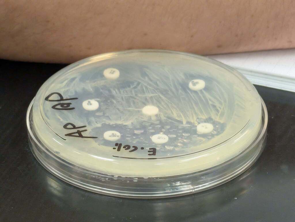 Close-up of a petri dish with clear lid, containing white substance and black text. Background shows a person's arm.
