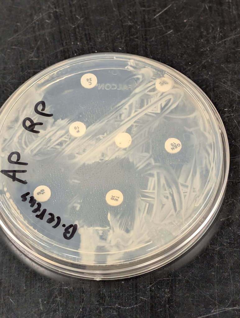 Clear petri dish with "AP RP" and "Bacteria" written in black. Round, white dots on the gel medium.