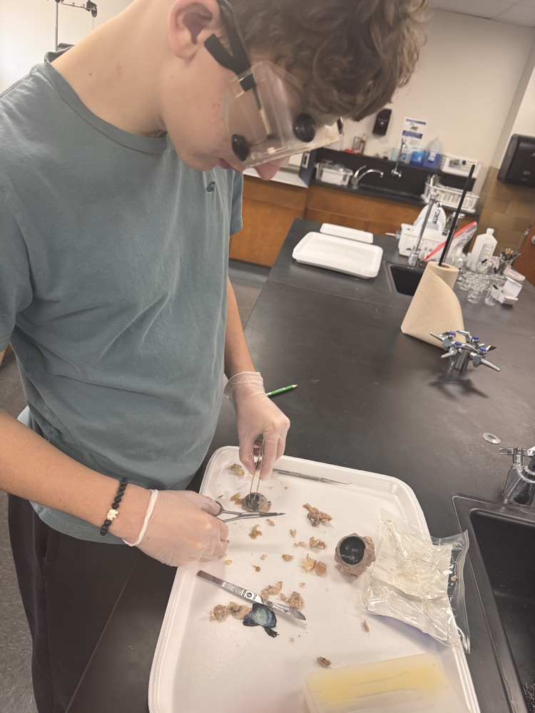 Examining the pupil and iris. 