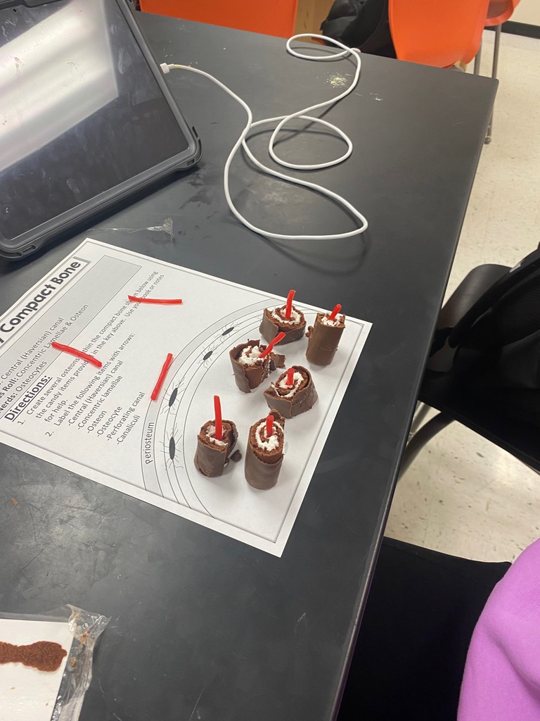 anatomy students thought outside of the box as they used candy and snacks to model compact bone: