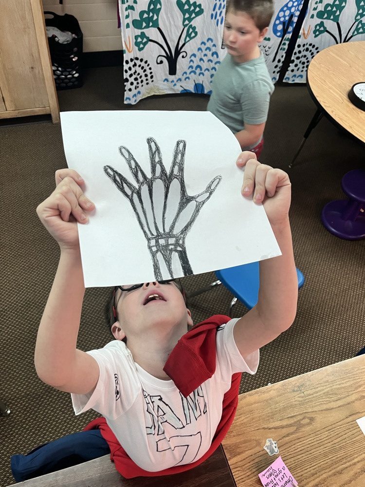 X-rays