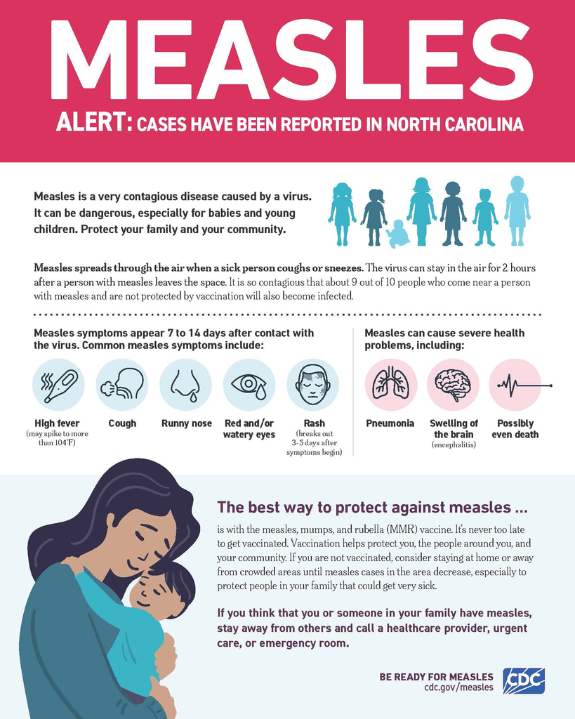 PCHD Measles Information (English)