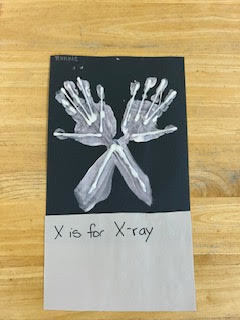 x is for xray project