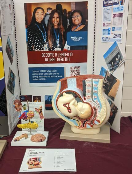 CTE expo pictures at RCH