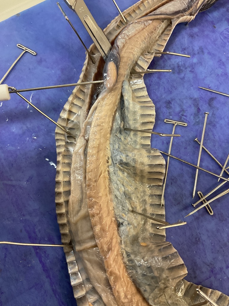 Dissection