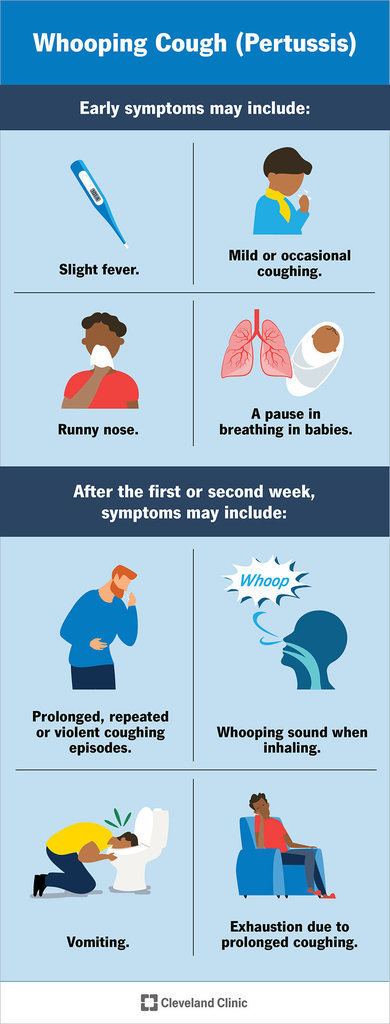 whooping cough informational poster