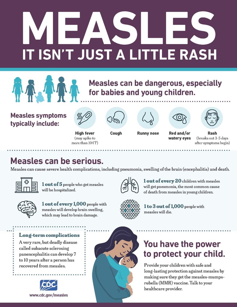 Measles Fact Sheet two