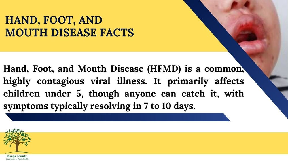 Hand Foot and Mouth Disease Facts banner