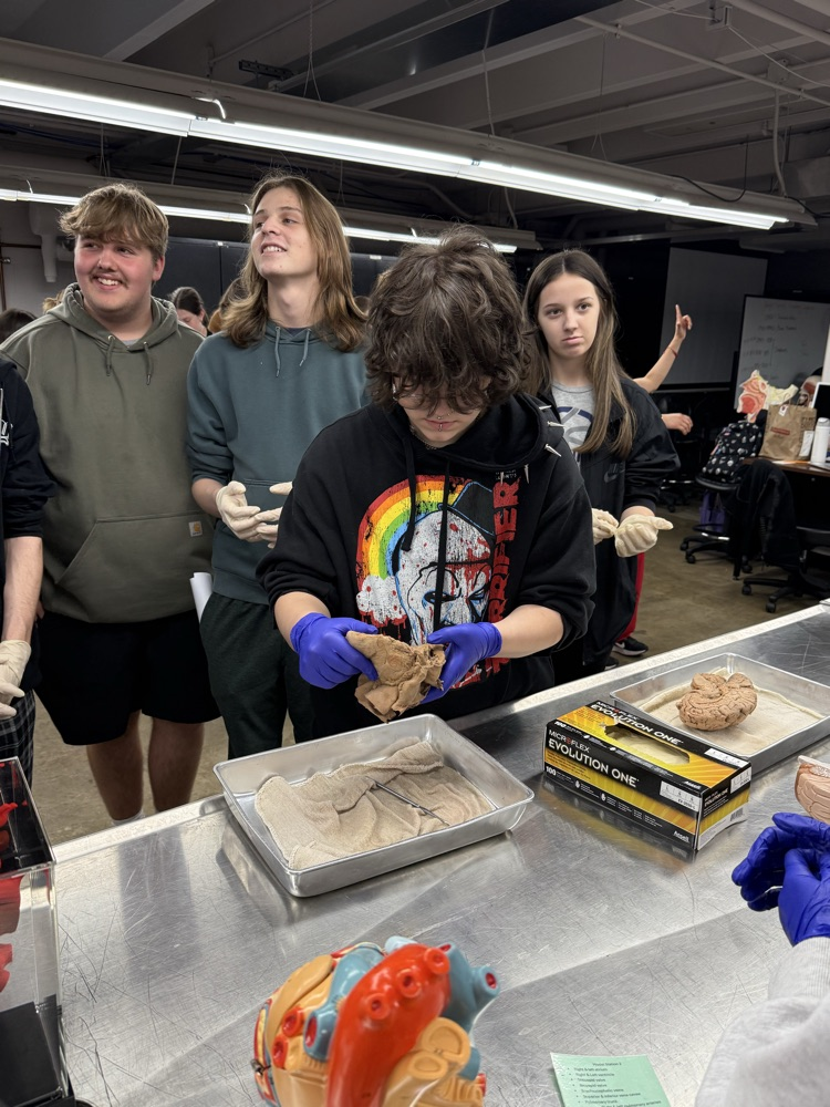 The Papillary Muscles are in here somewhere...