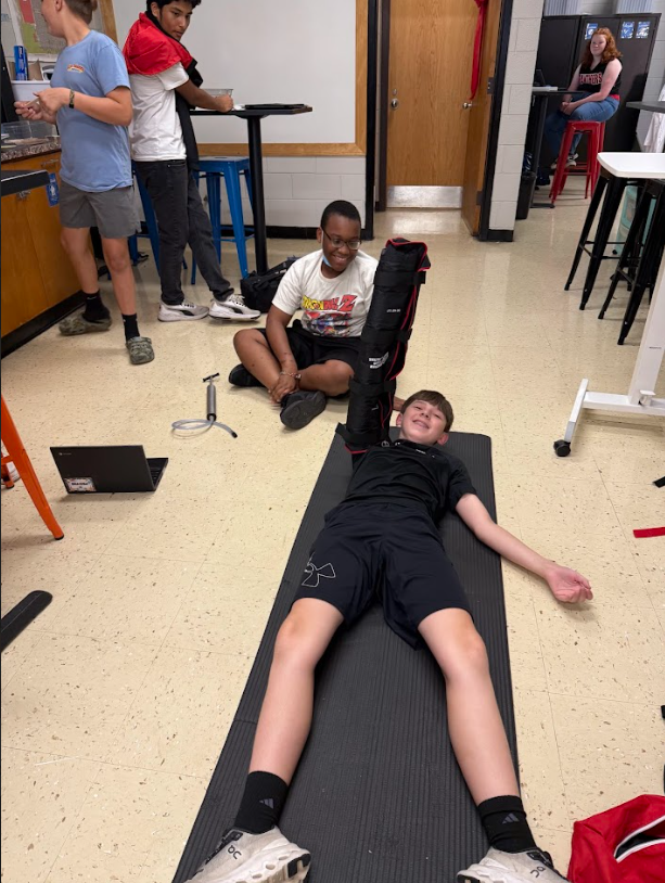 Instant splints being applied in EMT