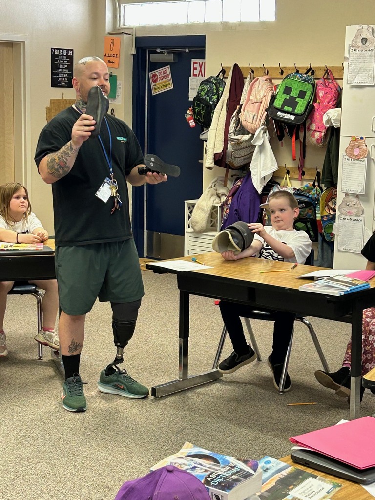 Prosthetic presentation