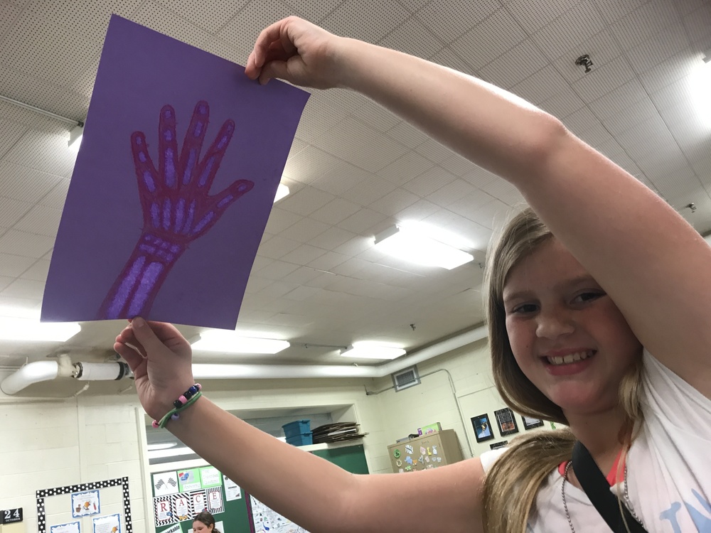 Olivia shares her "x-ray" hand!
