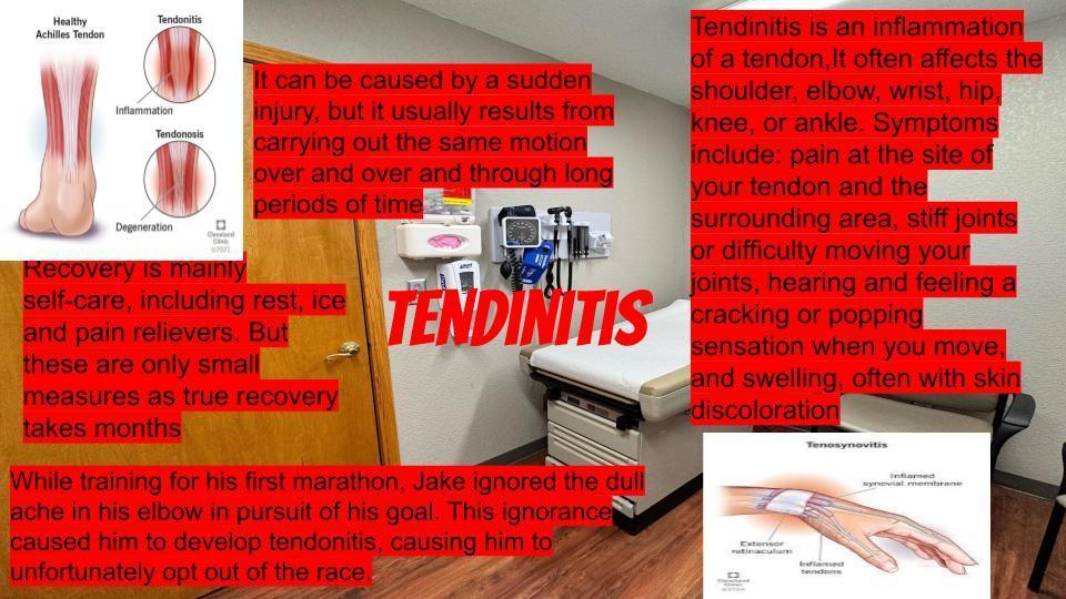 Tendinitis