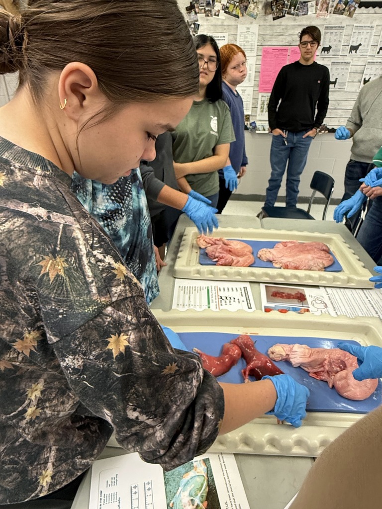 A student in a camouflage shirt and blue gloves focuses on manipulating an organ specimen on a blue dissection tray while other students stand and watch in the background.