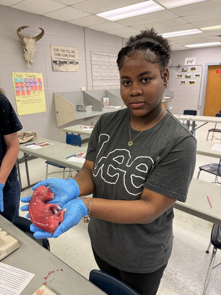 A young female student in a gray "LEE" shirt and blue gloves holds up a small, pink fetus/specimen in her hands, looking directly at the camera.