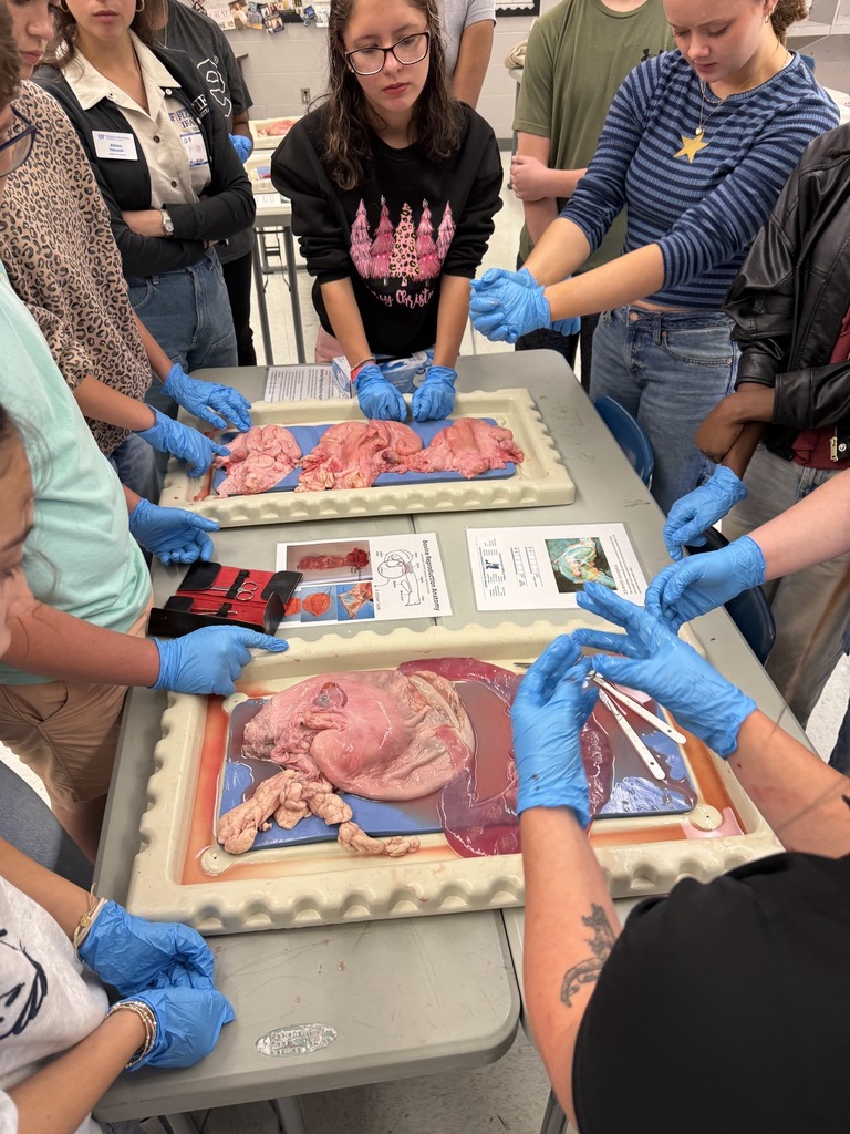 A close-up view of several students' hands, all in blue gloves, examining large pink organs and small dissection tools on two trays in a classroom.