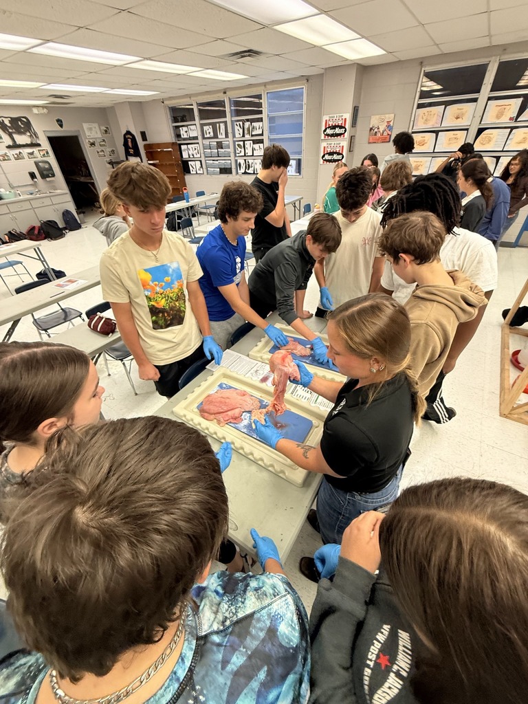 A group of high school students, wearing gloves, gathers closely around a table in a classroom to observe and handle internal organs displayed in a dissection tray.
