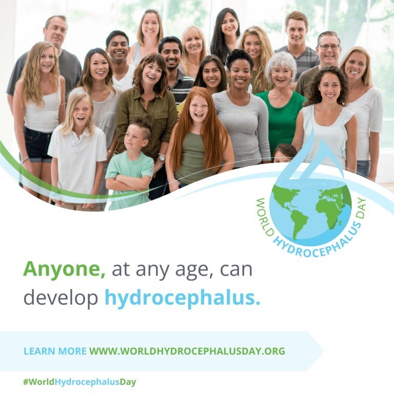 hyrocephalus