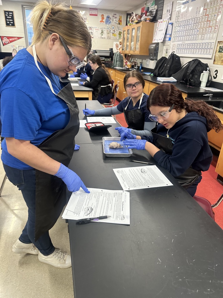 dissection of the brain