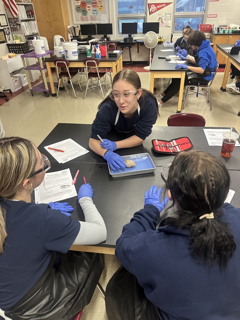 dissection of the brain