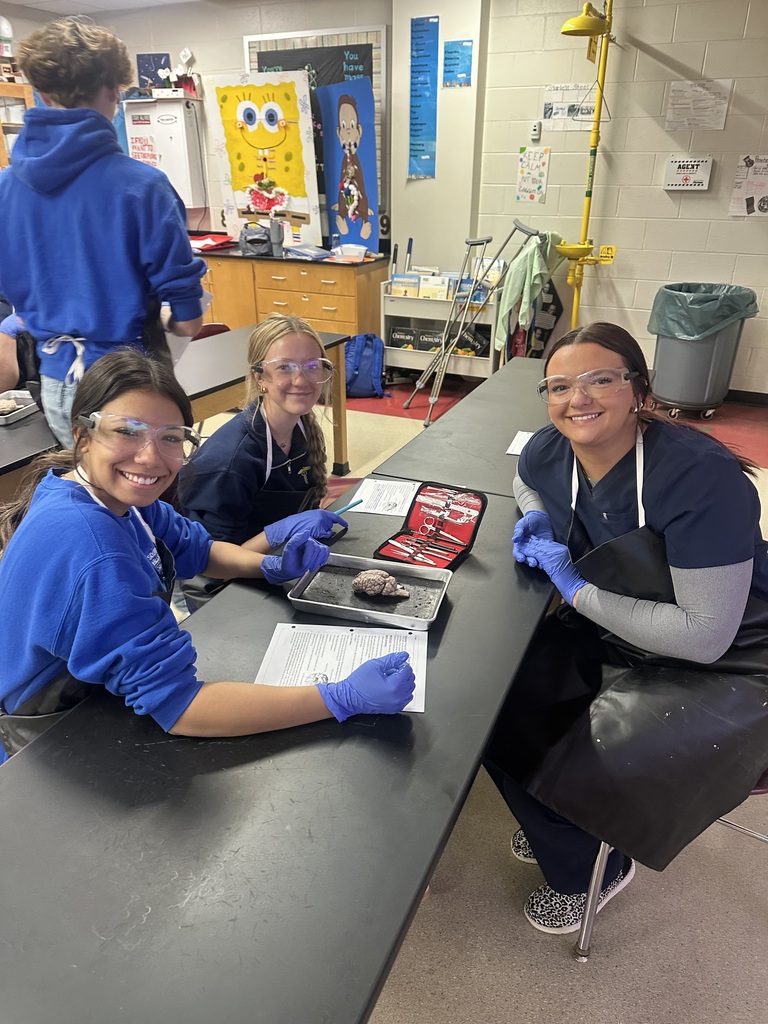 dissection of the brain